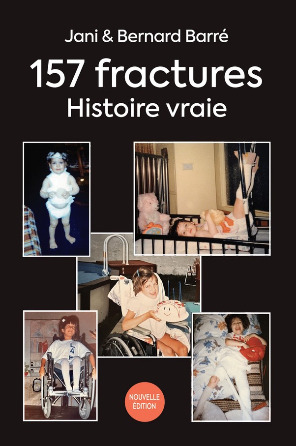 157 fractures Histoire vraie